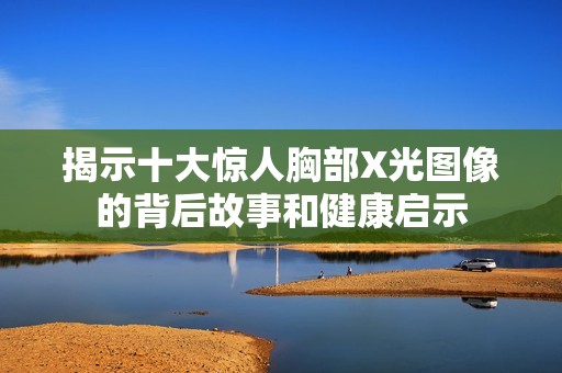 揭示十大惊人胸部X光图像的背后故事和健康启示